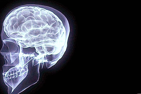 Como melhorar a função cerebral