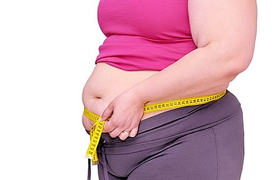 Kenapa berat badan berlebihan